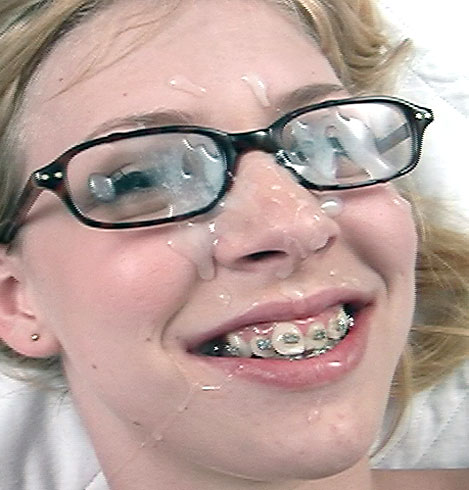 How to Rock Both Braces and Glasses: 14 Steps (with Pictures) .